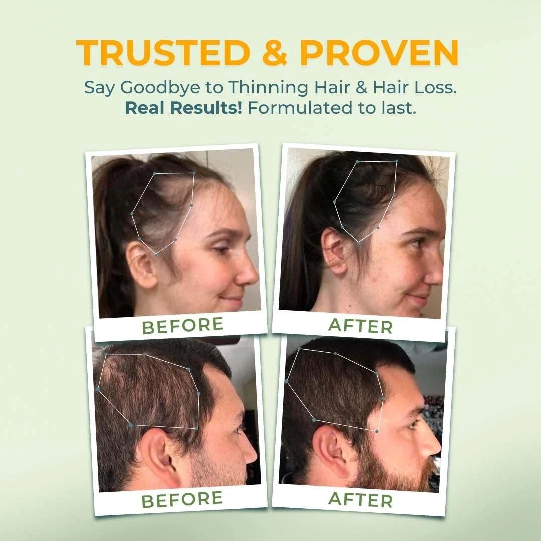 Before and after hair treatment results on a light green background with text 'Trusted & Proven'.